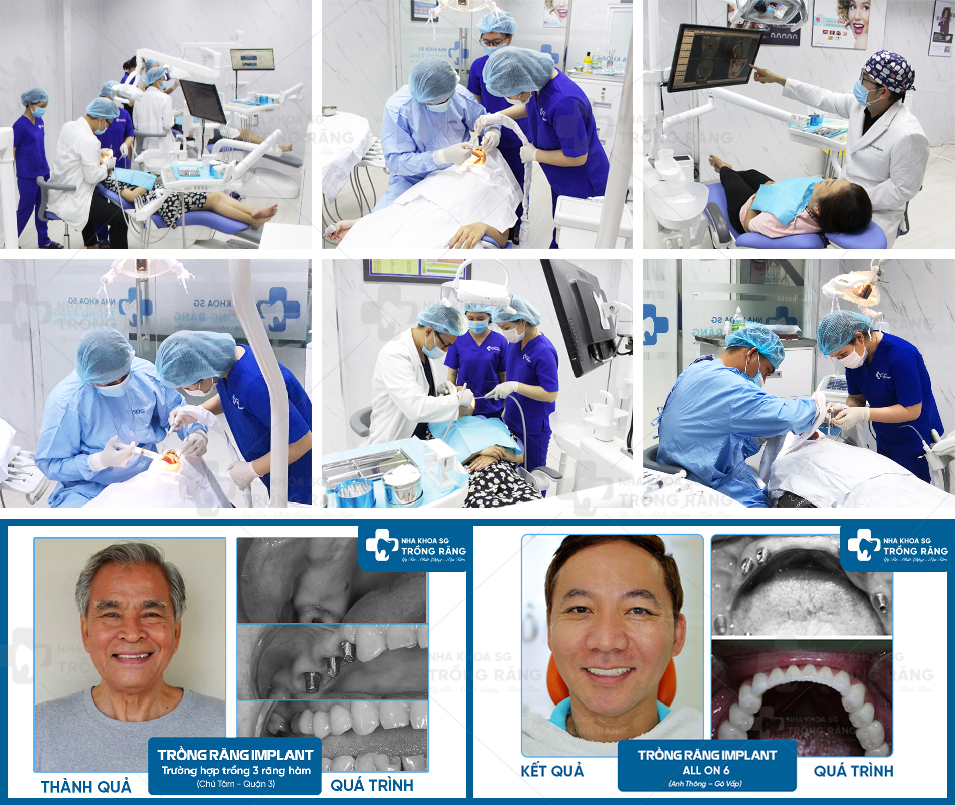 NHA KHOA TRỒNG RĂNG SÀI GÒN – QUẬN 10, TPHCM CÓ TỐT KHÔNG?