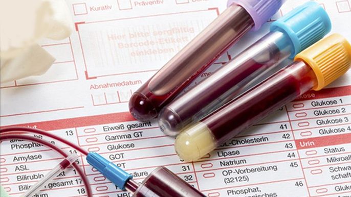 Cách chẩn đoán và điều trị tăng phospho máu cho người bệnh thận